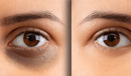 黑眼圈怎么导致的，如何避免？