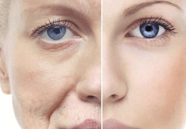 关于皮肤衰老的原因分析插图
