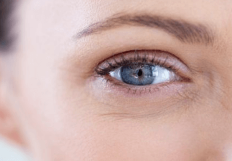 眼部细纹的改善方法