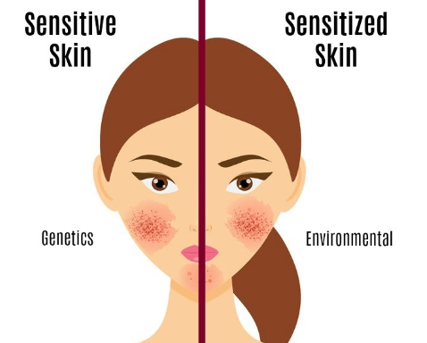 敏感肌肤怎么做好皮肤清洁插图