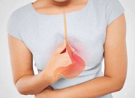 胃食管反流症状及缓解方法