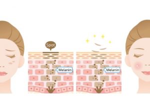 肌肤缺水变暗沉？三招补水很关键