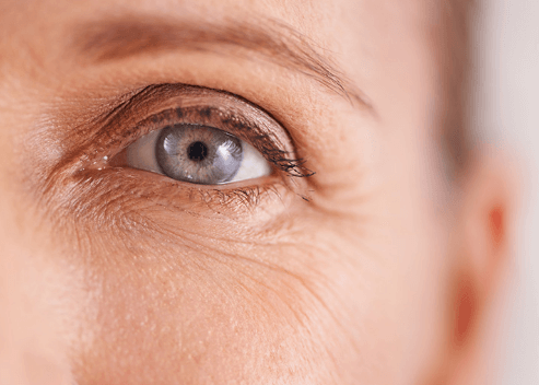 眼部细纹形成原因及改善方法