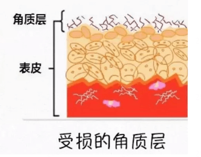 护肤品用得越多，皮肤就越差？插图