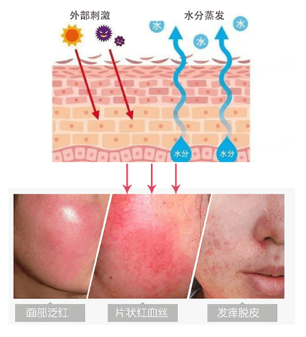 修复皮肤屏障，选神经酰胺和透明质酸插图