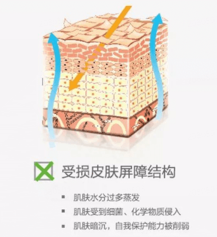 皮肤干敏、脱屑紧绷怎么护理插图 皮肤干敏、脱屑紧绷怎么护理插图