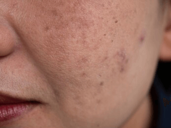 脸上同时存在多种皮肤问题怎么办