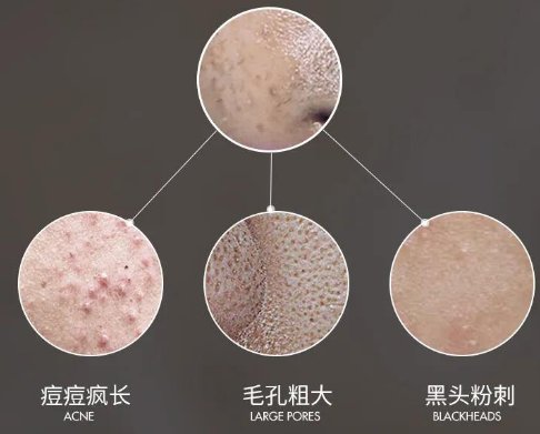 皮肤出油毛孔变大，跟吹空调有关？插图(1)