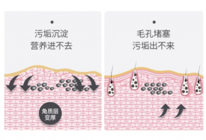 油皮怎么化妆不容易堵塞毛孔? - 伊的家