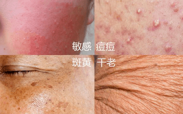 如何避免外在环境对皮肤的影响？插图