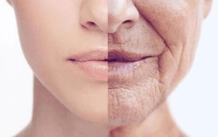 皮肤松弛衰老的根本原因