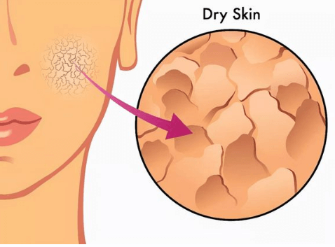 皮肤缺水的内外原因分析