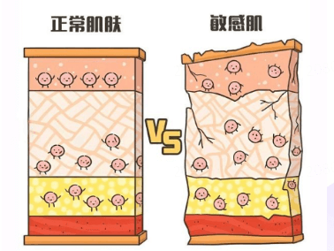 一晒就敏感？夏日敏敏肌护肤指南插图