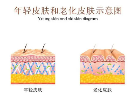 皮肤不同层次的衰老表现