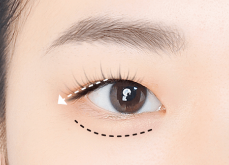 5种单眼皮眼妆画法，三倍大眼巨消肿插图(2)