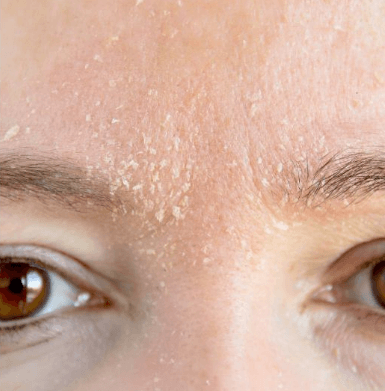 皮肤干脱妆是什么原因造成的