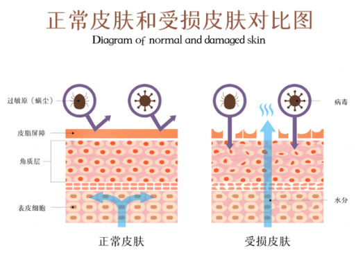 面部皮肤屏障受损的表现症状插图 面部皮肤屏障受损的表现症状插图