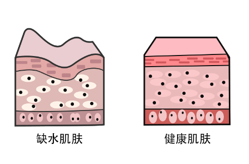 脸上皮肤干燥是什么原因造成的