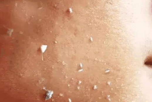 防晒霜擦了起泥是怎么回事