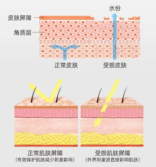 皮肤屏障受损是什么样子？