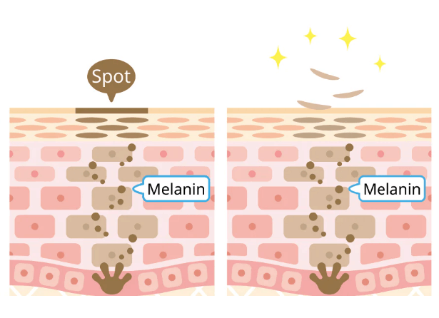 额头与脸肤色不均匀是什么原因引起的 额头与脸肤色不均匀是什么原因引起的