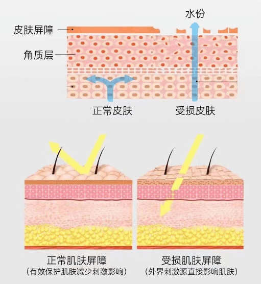 为什么会皮肤屏障受损