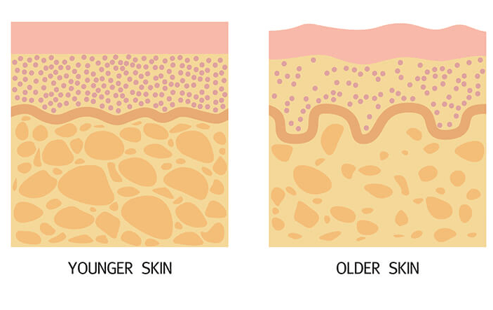 皮肤缺水会造成胶原蛋白流失吗