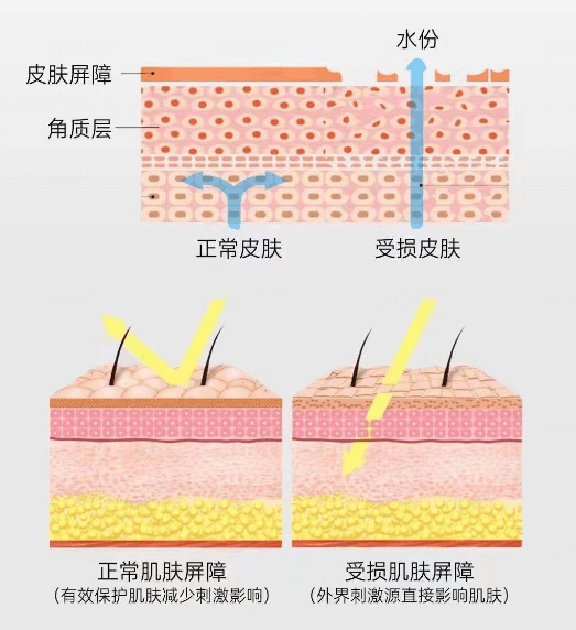 多种肌肤问题同时出现?先修复肌肤屏障