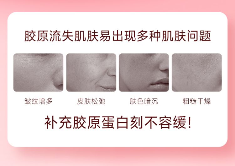 是否缺乏胶原蛋白?这些表现告诉你答案 是否缺乏胶原蛋白?这些表现告诉你答案