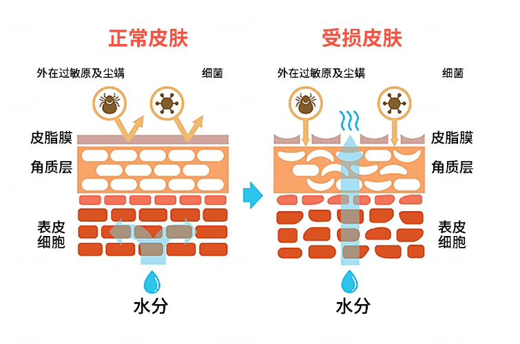 春季过敏高发期，如何科学护肤避免“敏感肌”?