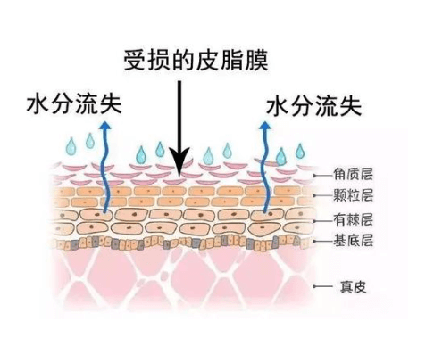 如何通过修复皮肤屏障告别“红脸蛋”?插图 如何通过修复皮肤屏障告别“红脸蛋”?插图