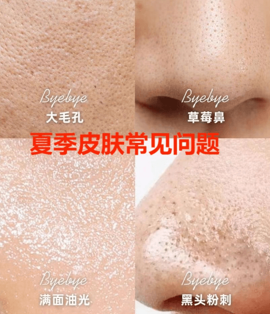 油皮“控油大作战”：如何科学管理油光满面?