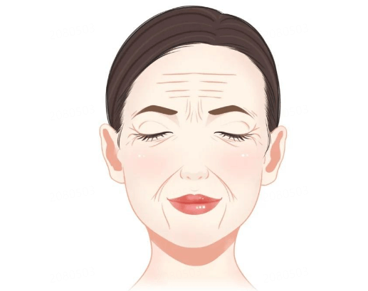 不是所有皱纹都叫衰老！教你快速分辨四大类型