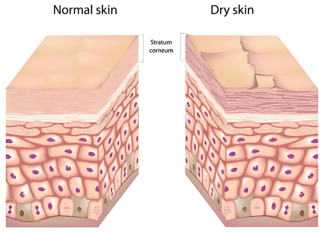 皮肤水合作用的跨层运输与动态平衡 皮肤水合作用的跨层运输与动态平衡