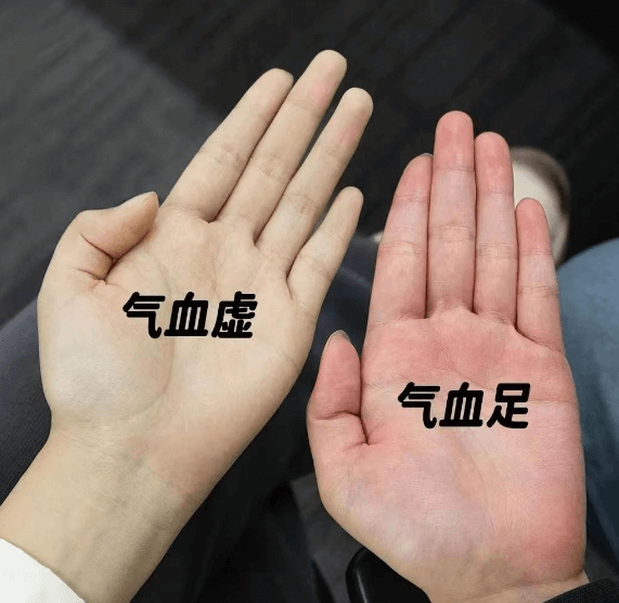 总觉得累?可能是“气血不足”在作祟 总觉得累?可能是“气血不足”在作祟