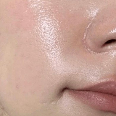 为什么你越控油,皮肤反而越油? 为什么你越控油,皮肤反而越油?