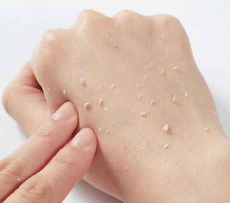 护肤品“搓泥”元凶：不是不吸收，是配方打架插图