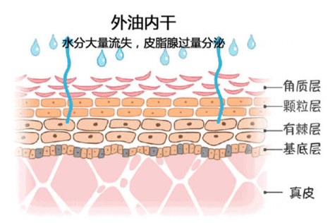 为什么皮肤会“外油内干”？如何拯救？