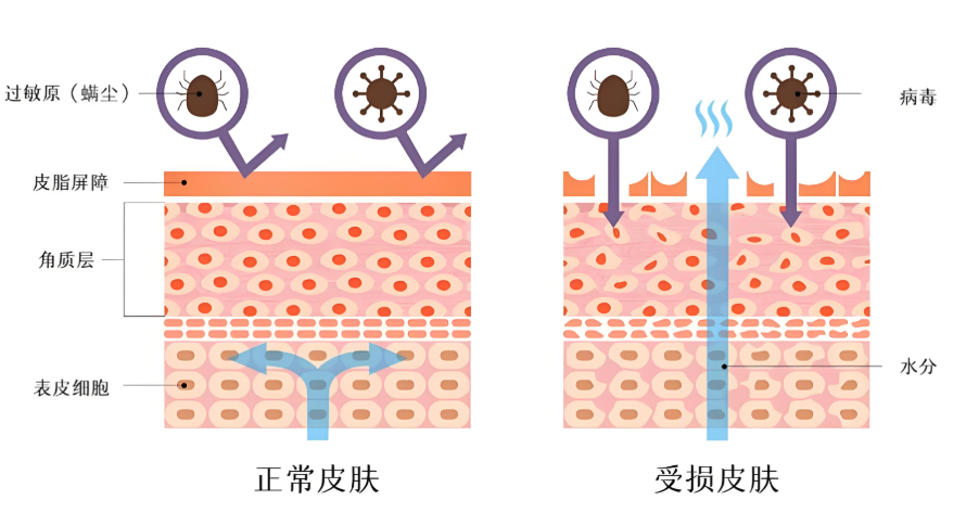 屏障受损全套护理流程：从早到晚，照着做就能稳