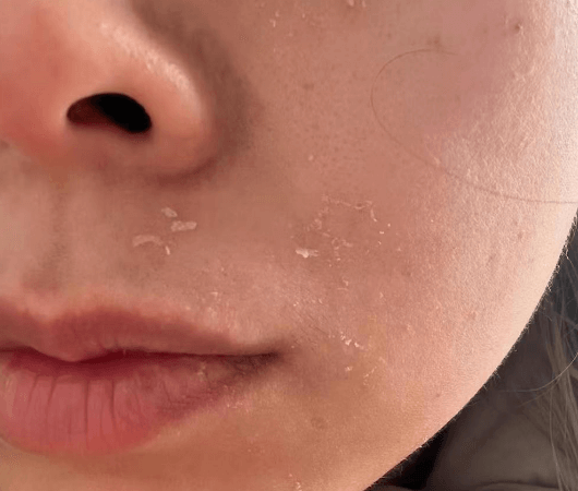 为什么每天补水脸还是干?你可能踩了这4个坑!