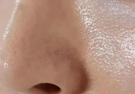 油皮毛孔粗?别猛控油!3步养出细腻“磨皮肌”