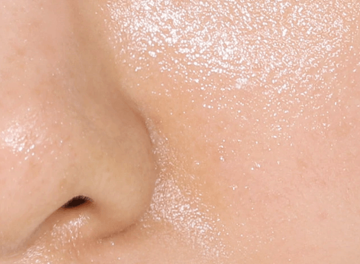 油性皮肤鼻子出油多怎么改善 油性皮肤鼻子出油多怎么改善