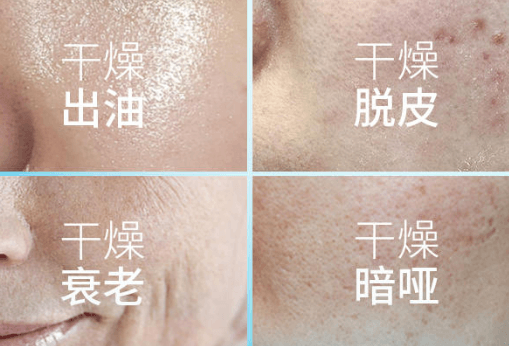 科学舒缓,重建肌肤屏障的核心方法 科学舒缓,重建肌肤屏障的核心方法