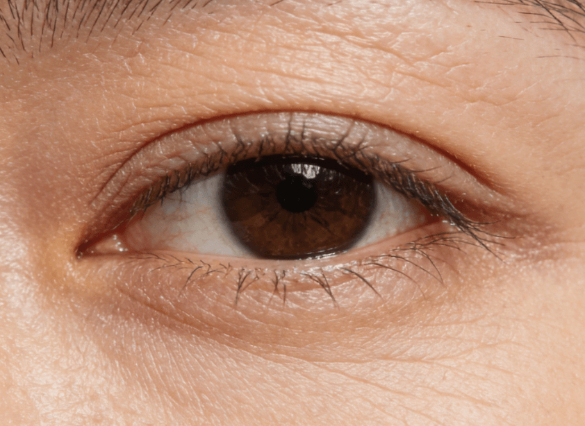 干纹细纹预防与淡化：从日常护理到内调辅助插图