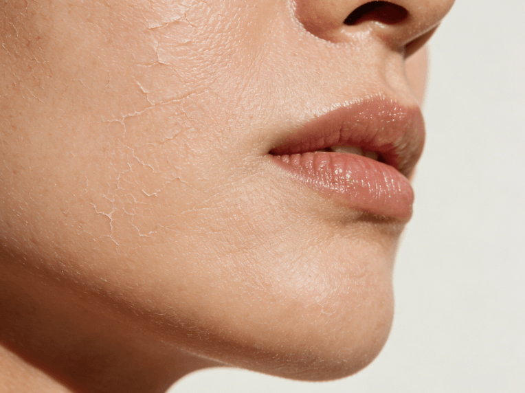 从“补水”到“锁水”，养出水润通透肌