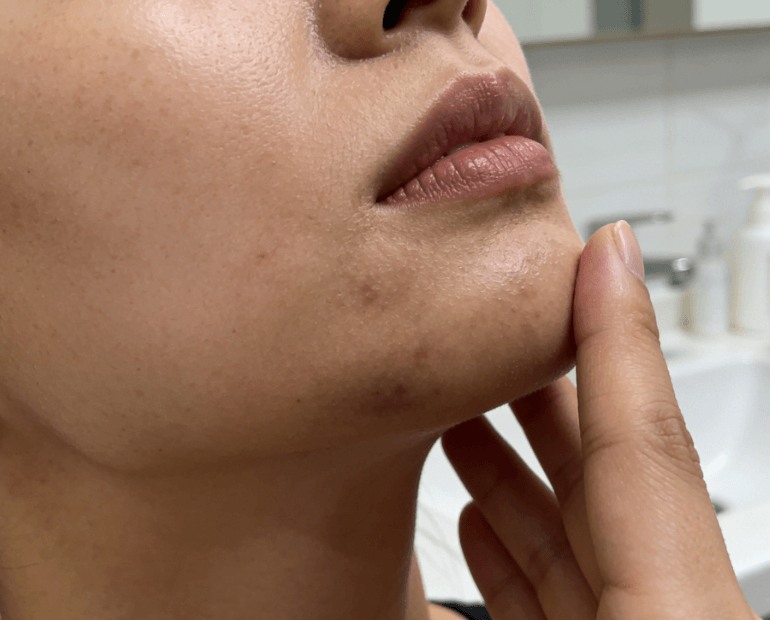 局部暗沉：找准诱因，精准提亮不盲目