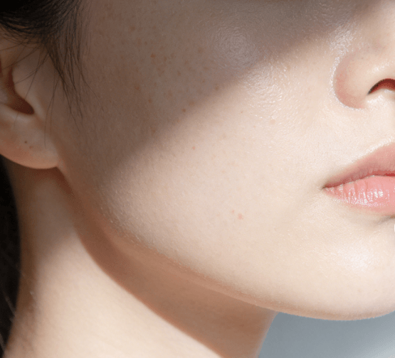 低糖饮食：从根源改善肌肤黄气、暗沉与爆痘插图