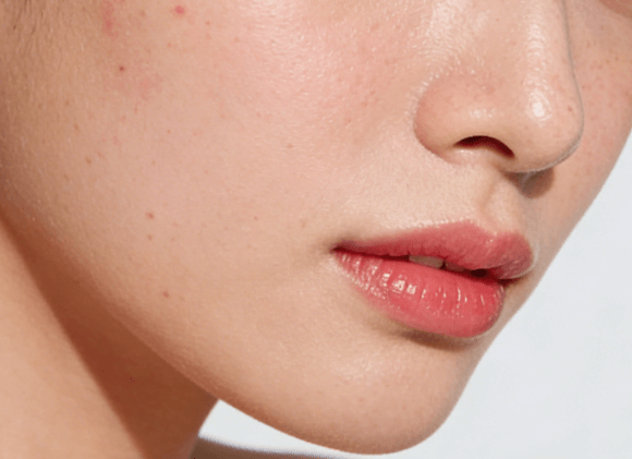 祛痘控油的底层逻辑，新手也能看懂