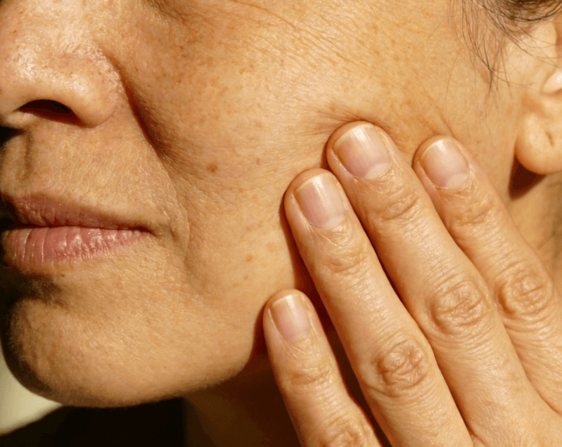 产后肤质变差：熬夜+激素波动的双重修复方案