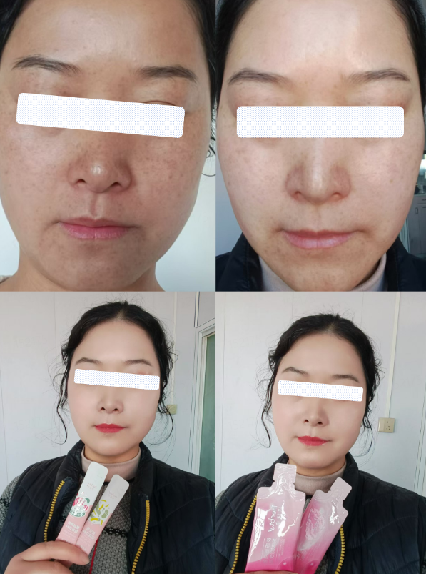 伊的家护肤达人绿绿：用实打实的专业，守护无数姐妹的肌肤健康插图(3)